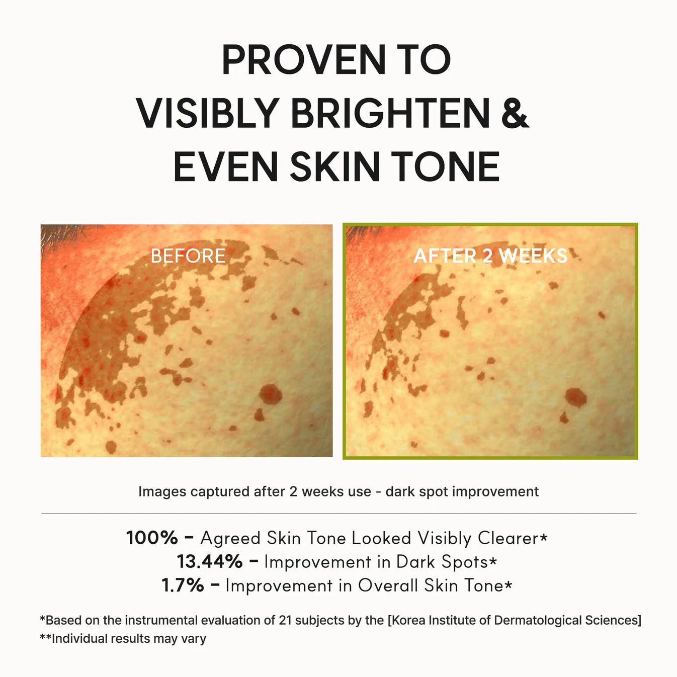 Vitamin C Booster Shot Serum For Dark Spots - 30 ml