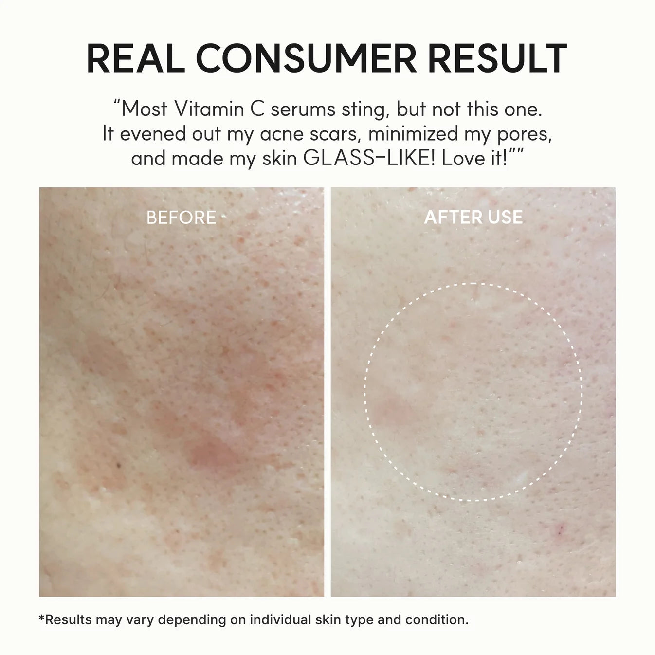 Vitamin C Booster Shot Serum For Dark Spots - 30 ml